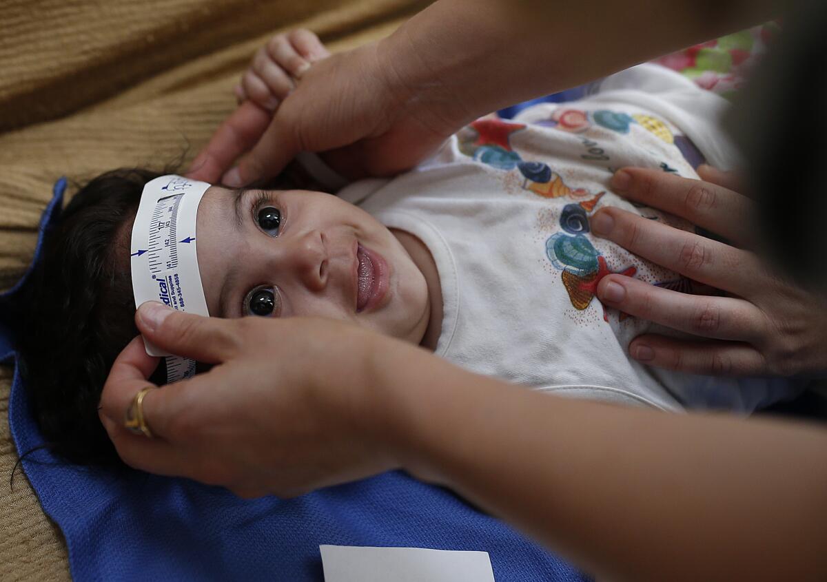 Three-month-old Esther Kamilly has her head measured by Brazilian and U.S. health workers from the U.S. Centers for Disease Control and Prevention at her home in Joao Pessoa, Brazil. The health workers are conducting a study to determine whether the Zika virus is causing babies to be born with a birth defect affecting the brain.