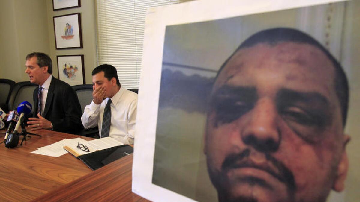 Gabriel Carrillo escucha al abogado Ronald Kaye, junto a una imagen del rostro de Carrillo después de un encuentro con oficiales del sheriff del condado de Los Ángeles en mayo de 2014.
