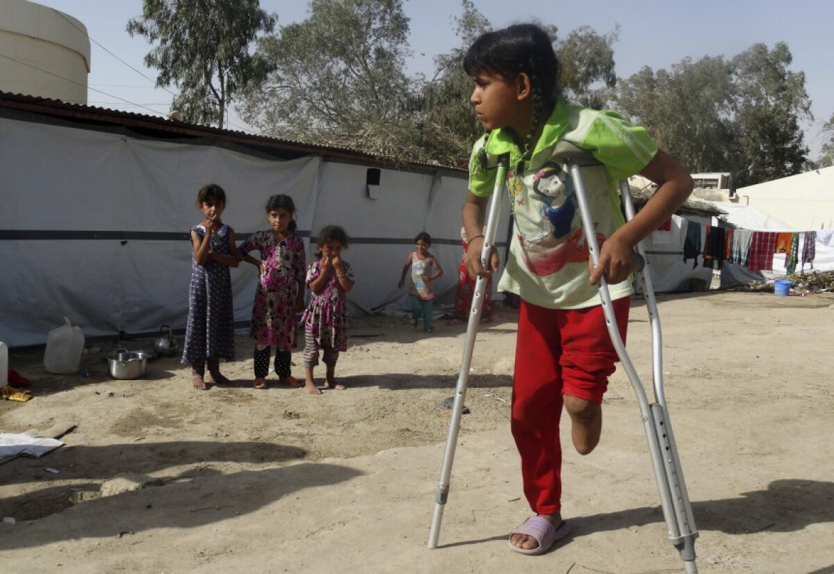 Hala Hussein, de 9 años, perdió su pierna cuando extremistas del Estado Islámico bombardearon su vecindario en el norte de Ramadi, observa algo afuera de la tienda de su familia en un campamento establecido para refugiados desplazados en Habaniya, a 80 kilómetros (50 millas) al oeste de Bagdad, Irak.