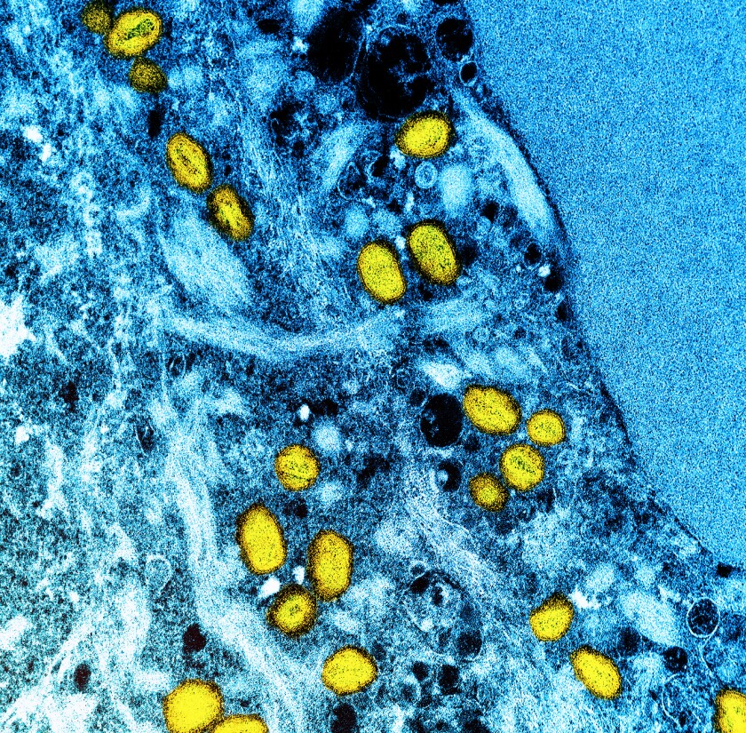 عکس میکروسکوپی از یک سلول، با رنگ آبی، آلوده به ذرات آبله میمون، به رنگ زرد نشان داده شده است.
