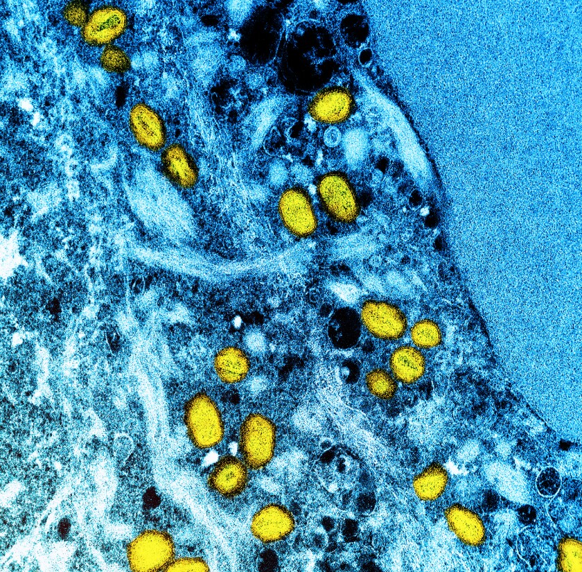 Une photo au microscope d'une cellule, représentée en bleu, infectée par des particules de monkeypox, en jaune