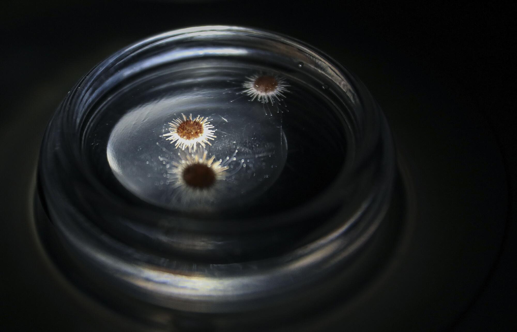 Sea urchins in a microscope dish