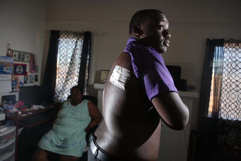 Jamar Nicholson shows a bullet wound on his back. Nicholson was shot Feb. 10 in an alley in South L.A. by an LAPD officer.