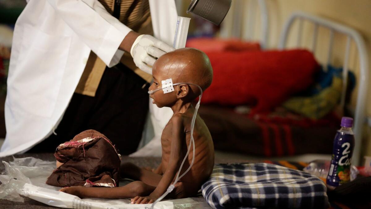 A malnourished child receives heathcare at a feeding center run by Doctors Without Borders in Maiduguri, Nigeria, in August 2016.