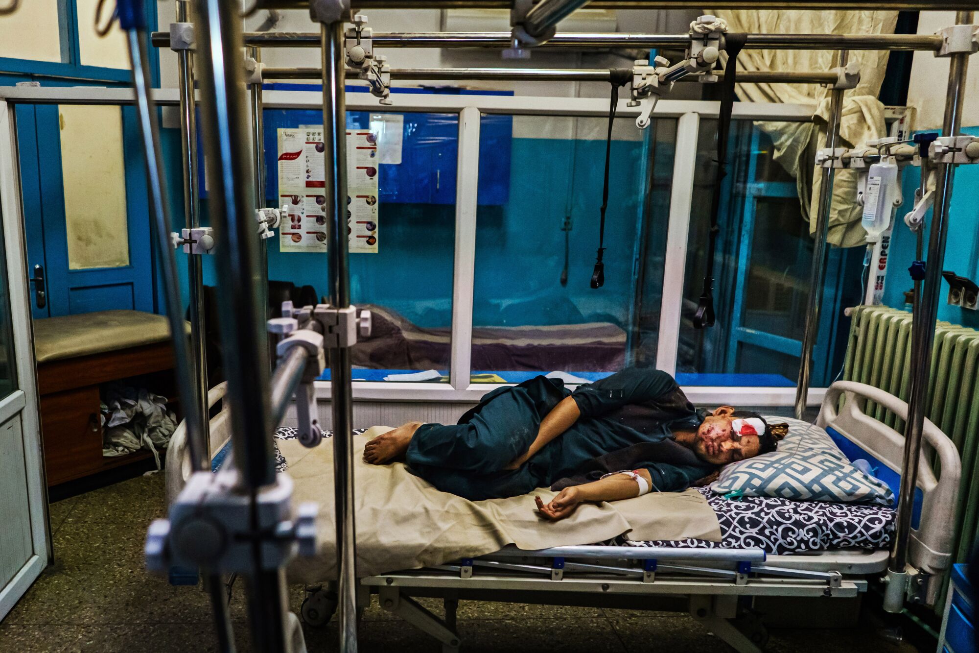 A wounded patient sleeps on a hospital bed after a suicide bomber struck the Kabul airport.