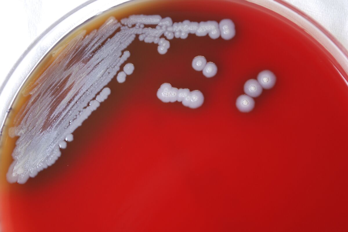 Varias colonias de la bacteria burkholderia pseudomallei, que puede causar melioidosis, una enfermedad rara 