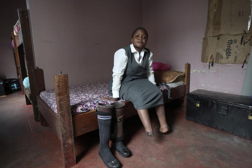 Bridget Chanda sits on her bed next to her prosthetic legs inside her dormitory at the Chileshe Chepela Special School in Kasama, Zambia, Thursday, March 7, 2024. Her lower legs were amputated after she developed gangrene. (AP Photo/Tsvangirayi Mukwazhi)