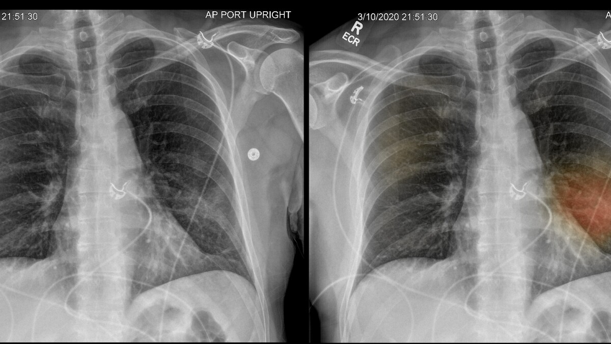 Cómo saber si tengo pulmones saludables: Las 7 señales que le están  fallando - Los Angeles Times