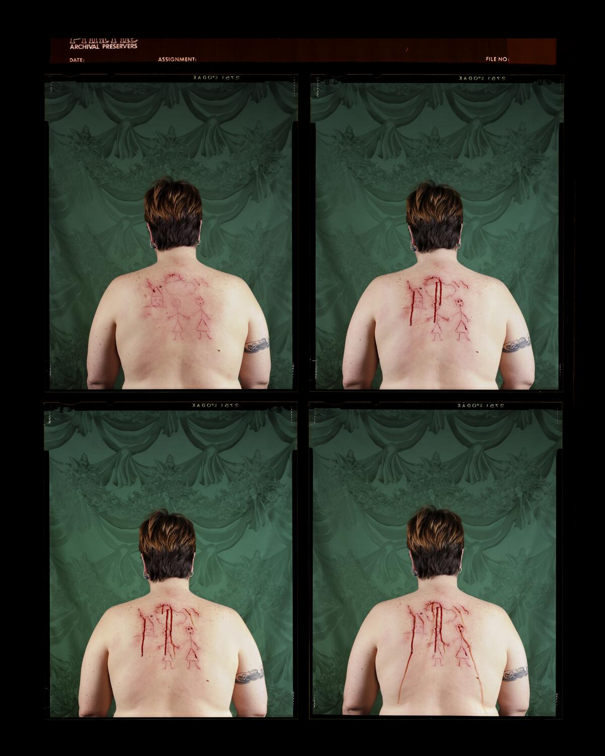 Four stacked images show blood running down a woman's bare back in order of increasing bloodiness. 