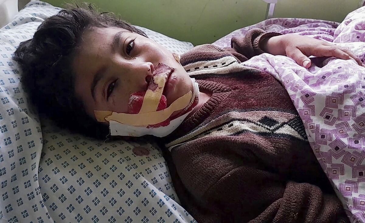 Un niño herido recibe atención médica en un hospital luego de una explosión de una bomba en una escuela religiosa de Aybak, capital de la provincia de Samangan, en el norte de Afganistán, el miércoles 30 de noviembre de 2022. (AP Foto/Saifullah Karimi)