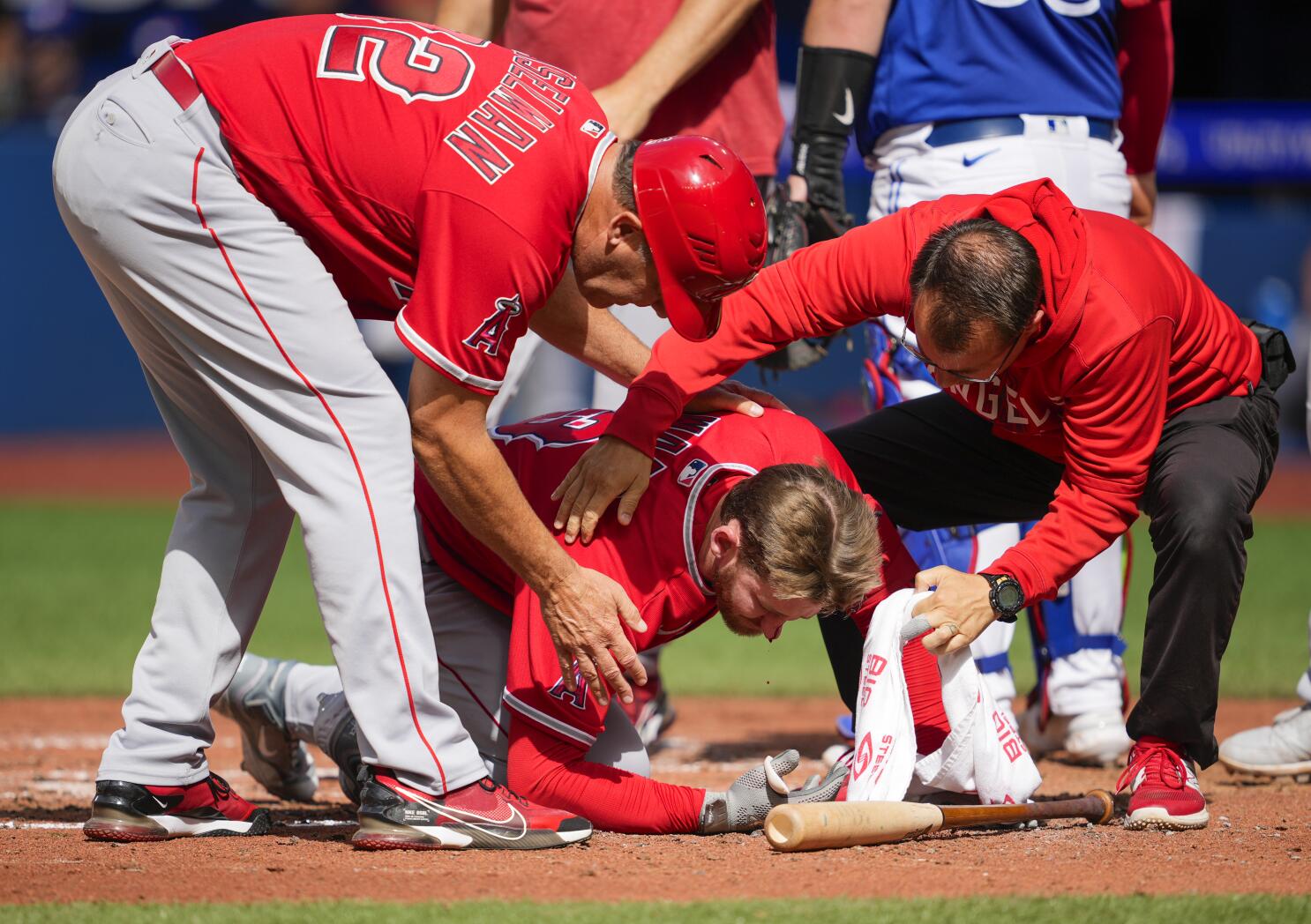 Angels' Taylor Ward bloodied, carted off after taking pitch to face