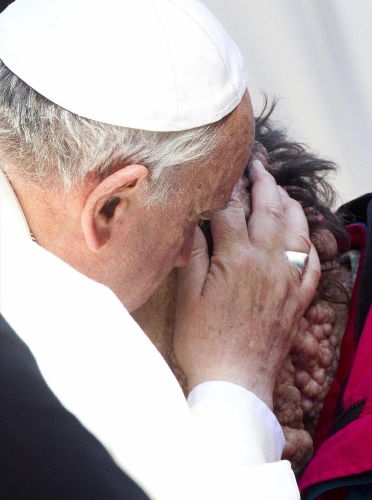 Pope Francis embraces a man believed to have neurofibromatosis.