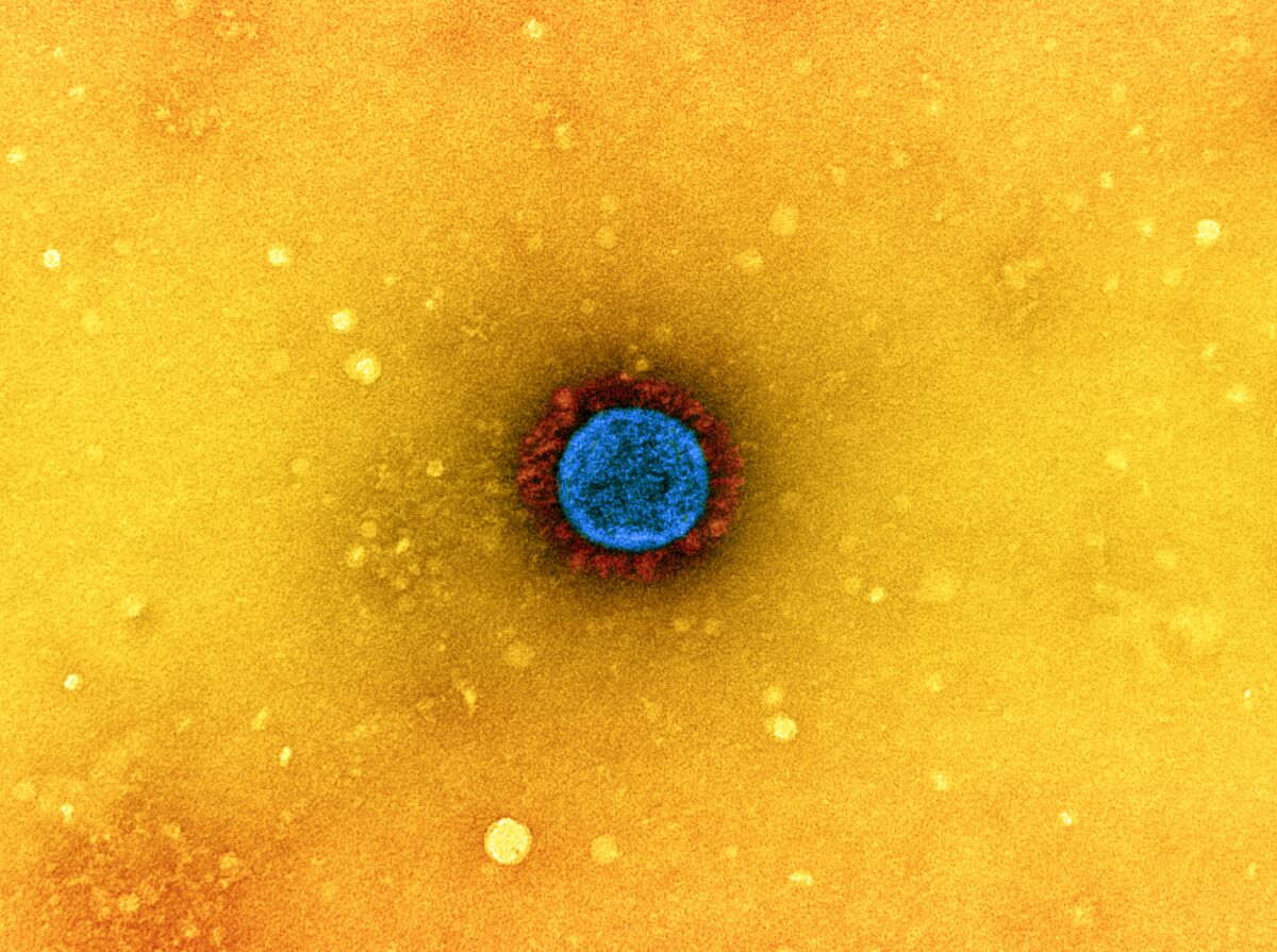 Vista ampliada de una partícula de coronavirus
