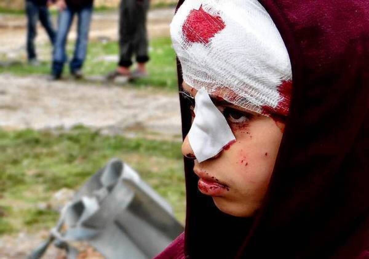 A Syrian child said to have been injured during military bombing in the town of Hanano, is shown in an image taken by an opposition activist.