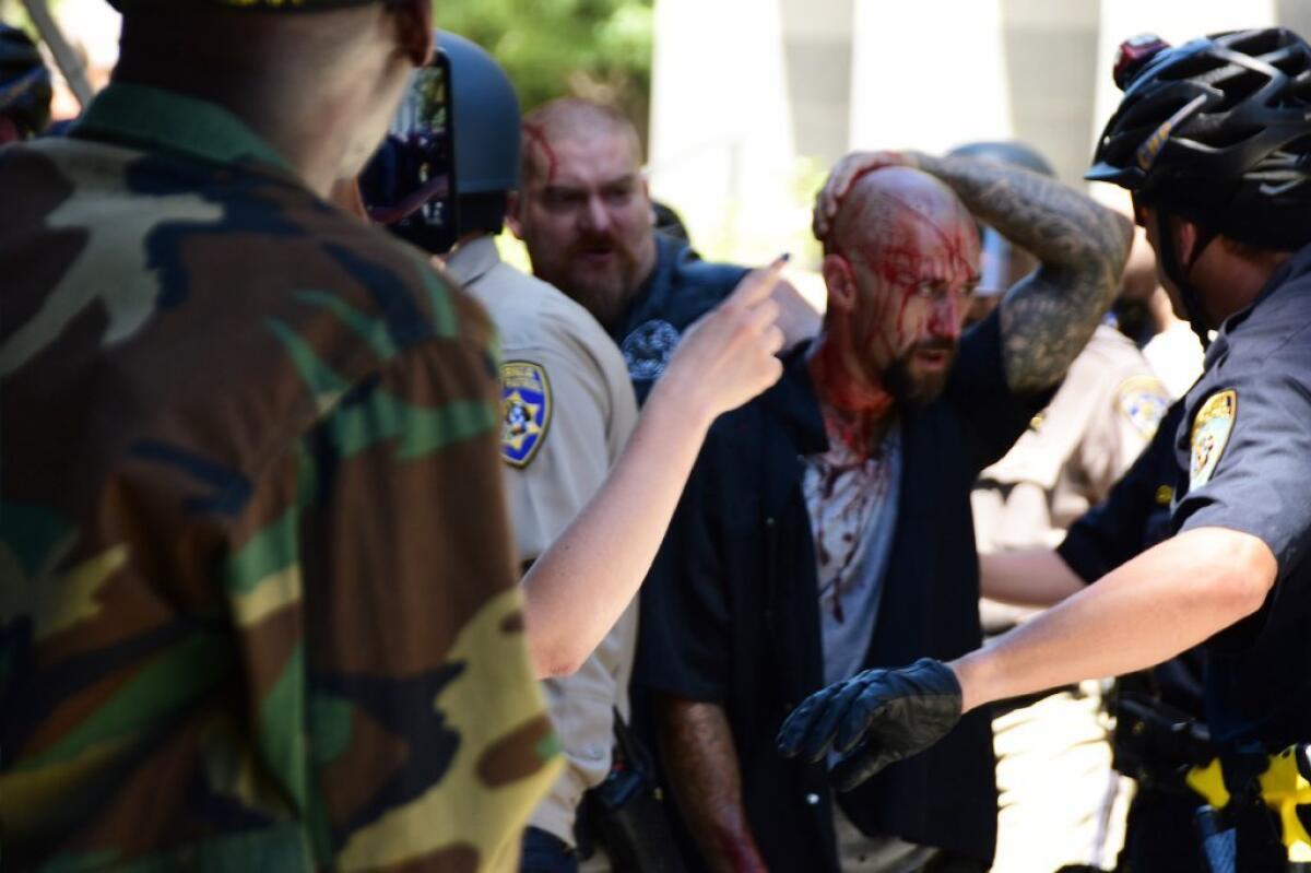 Police escort a wounded man away from the Capitol in Sacramento after a clash between far-right groups and counter-protesters turned violent, leaving at least seven people injured Sunday.