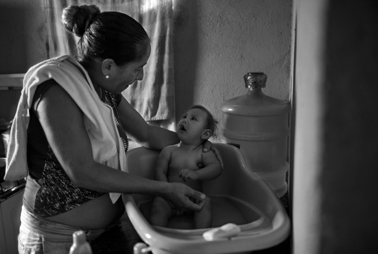 Gilberto is easily agitated and cries incessantly. A bath is often the only way to soothe him.