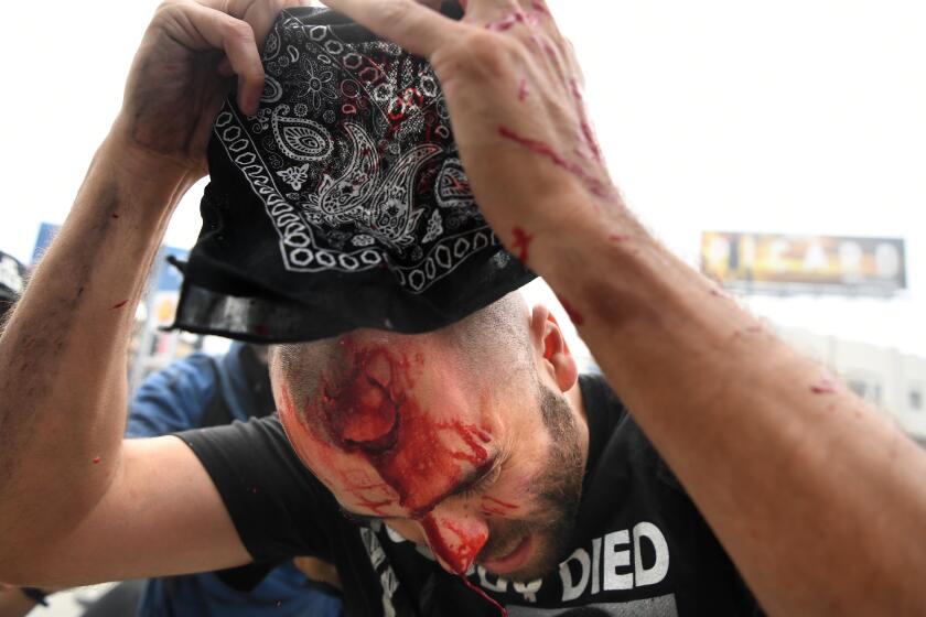 LOS ANGELES, CALIFORNIA MAY 30, 2020-A protestor runs for safety after being shot with a rubber projectile from LAPD officers at 3rd St. and Fairfax Ave. in Los Angeles Saturday. (Wally Skalij/Los Angeles Times)