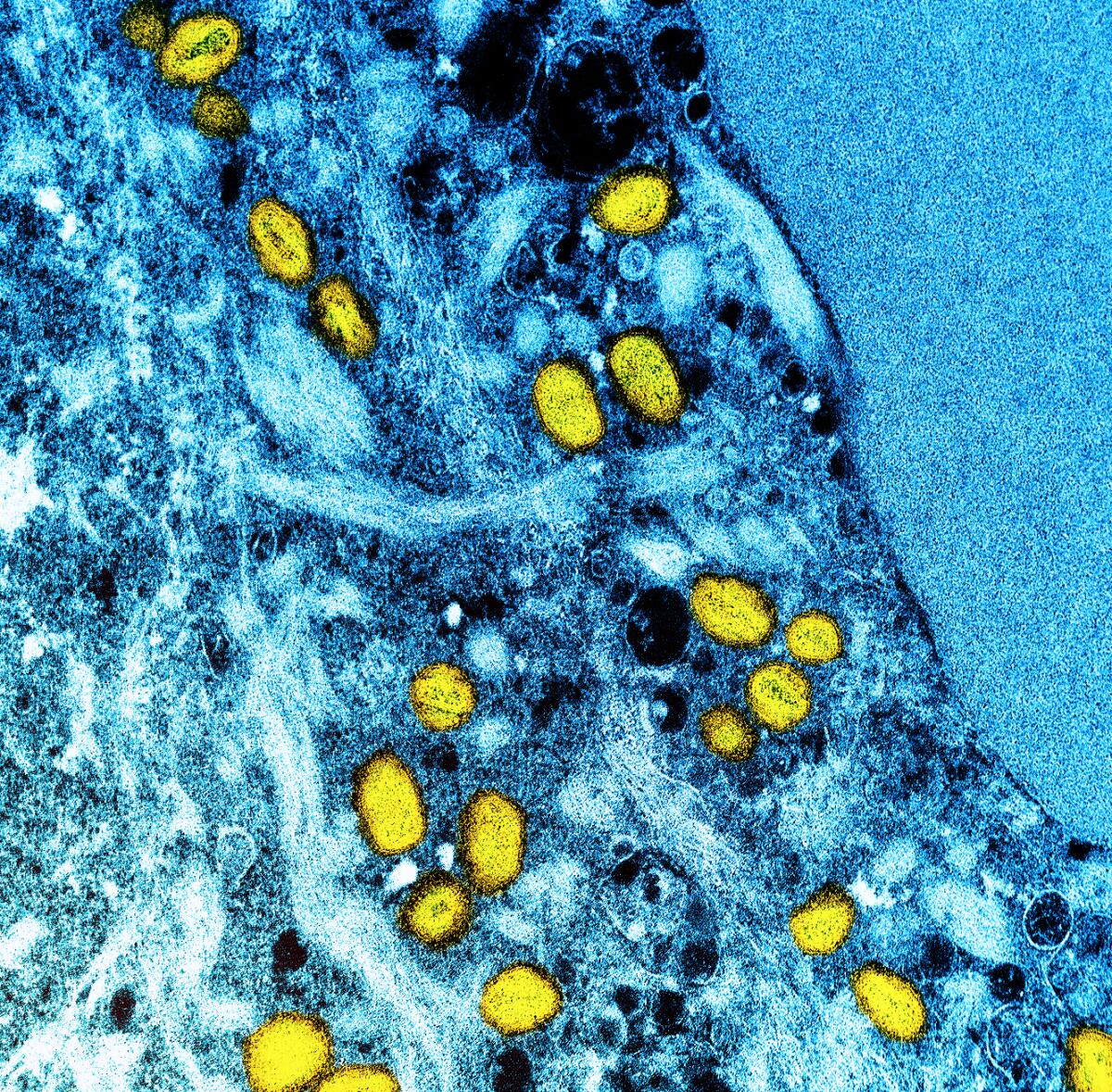 A microscope photo of a cell, shown in blue, infected by monkeypox particles, in yellow