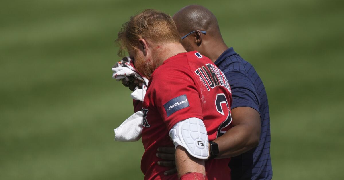 Justin Turner says he suffered no fractures after taking pitch to face -  CBS Boston