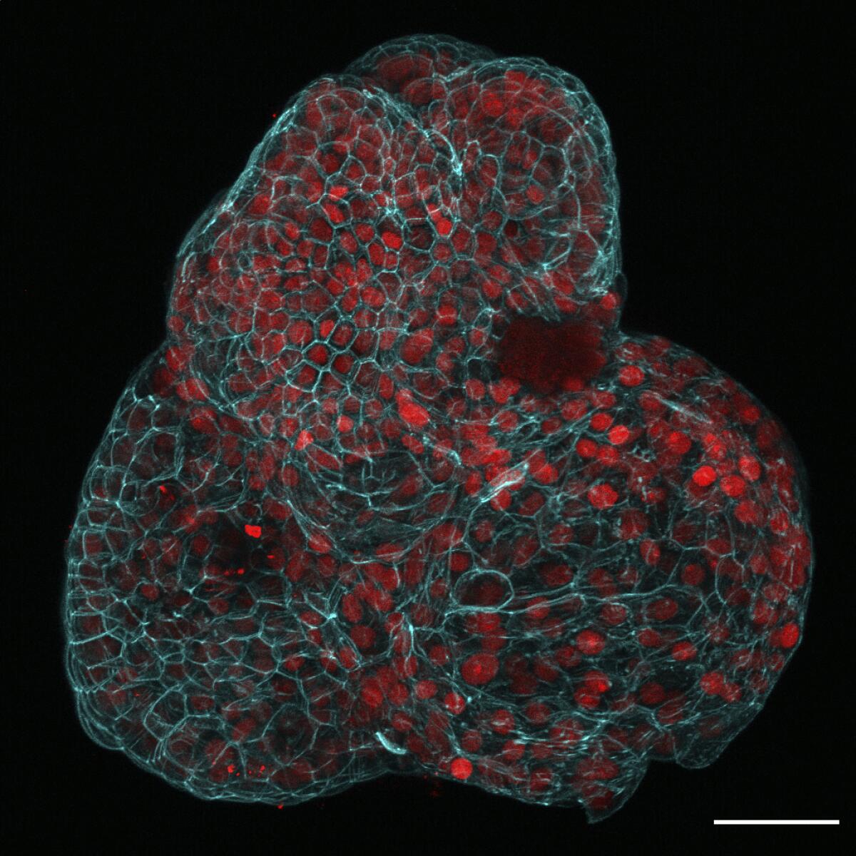 Esta imagen de microscopio facilitada por los investigadores en marzo de 2024 muestra un organoide pulmonar creado a partir de clulas recogidas del lquido amnitico. (Giuseppe Cal, Paolo De Coppi, Mattia Gerli via AP)