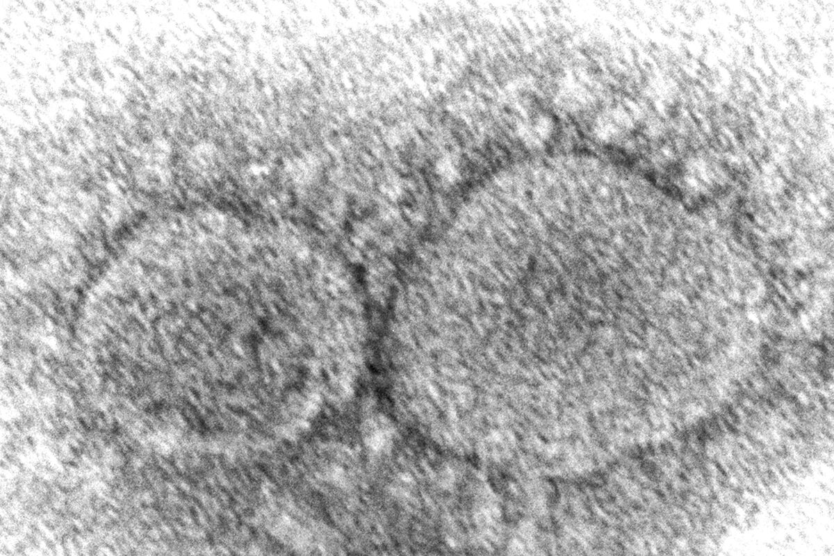 SARS-CoV-2 coronavirus particles under a microscope. 