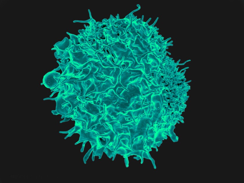 A colorized image of a T cell seen with a scanning electron microscope.
