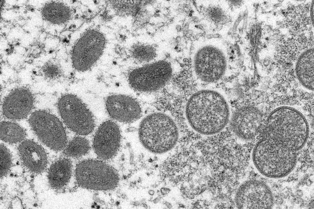 Mature, oval-shaped monkeypox virions, left, and spherical immature virions, right, seen under an  electron microscope.