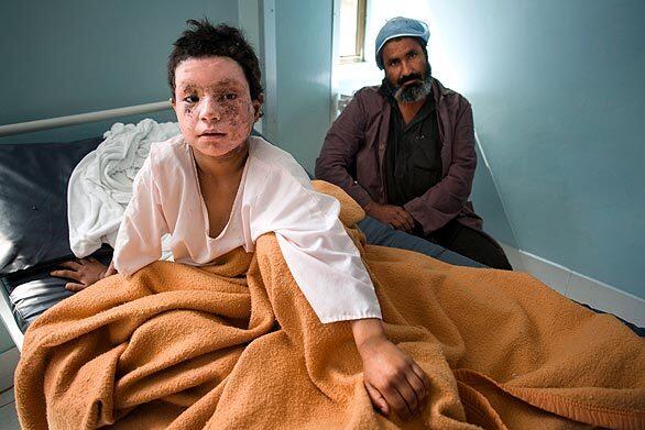 Afghan children in crossfire