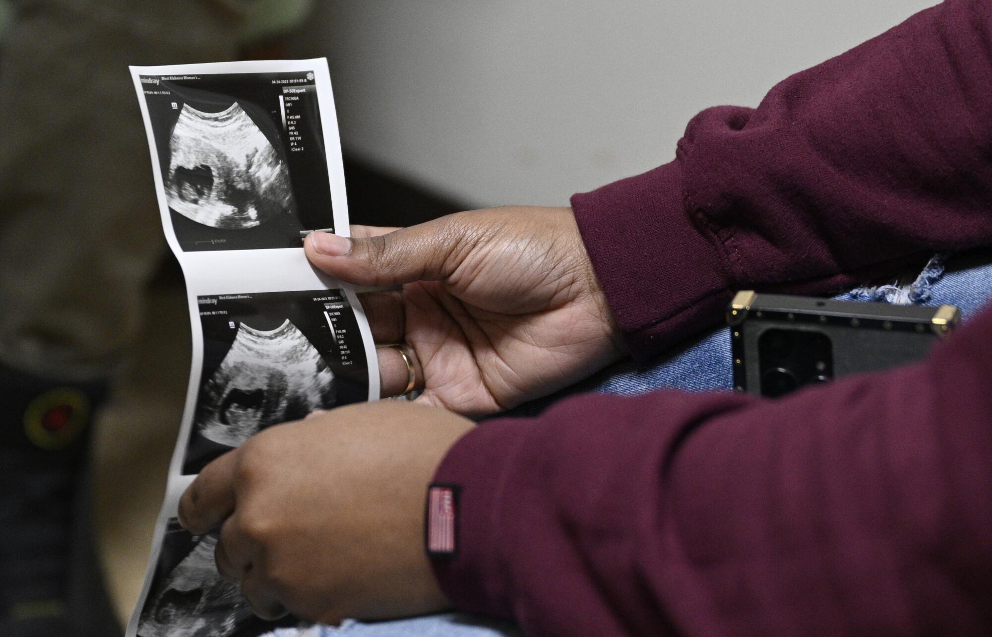A woman holds images of her 10-week-old fetus. 