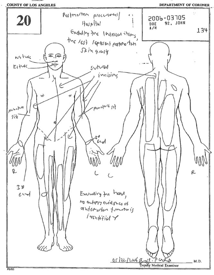 Key cases where death probes were complicated by harvesting of body