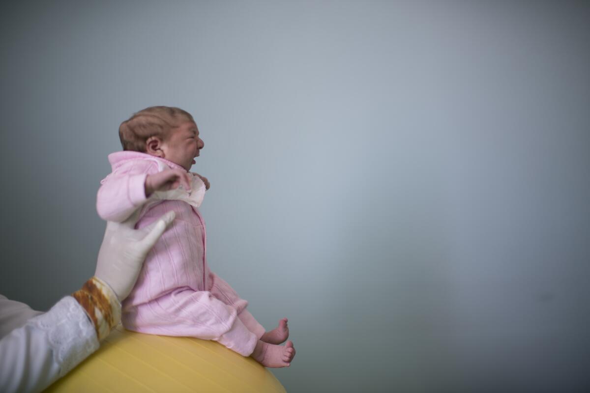 A 2-week-old baby girl, born with microcephaly, during a physical therapy session in Campina Grande, Brazil.