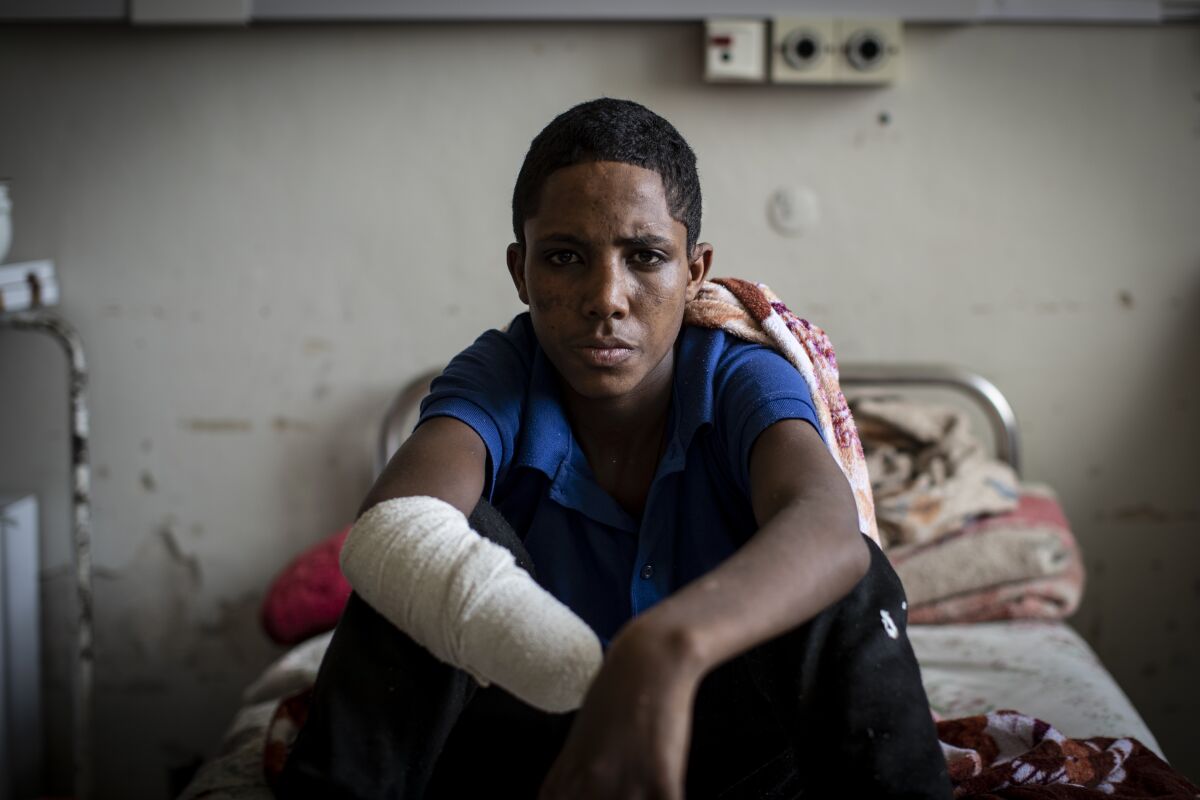 FILE - Haftom Gebretsadik, a 17-year-old from Freweini, Ethiopia, near Hawzen, who had his right hand amputated and lost fingers on his left after an artillery round struck his home in March, sits on his bed at the Ayder Referral Hospital in Mekele, in the Tigray region of northern Ethiopia, on May 6, 2021. A year after war began there, the findings of the only human rights investigation allowed in Ethiopia's blockaded Tigray region will be released Wednesday, Nov. 3, 2021. (AP Photo/Ben Curtis, File)