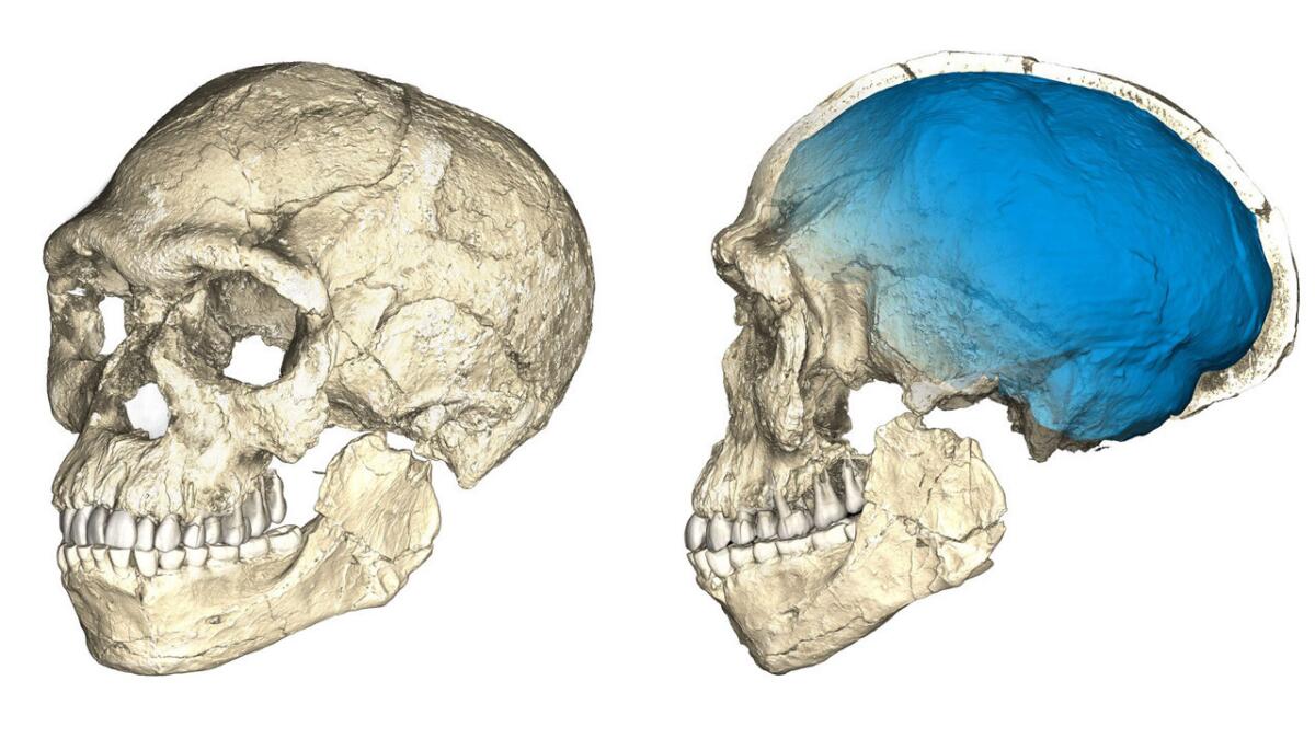 Pin en HOMO SAPIENS ?