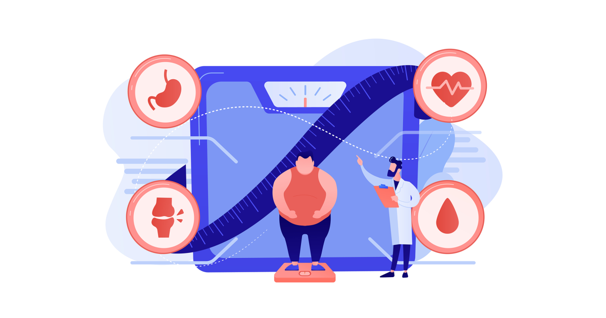 retatrutide obesity Retatrutide Severe Obesity Trial Shows 30% Weight Loss