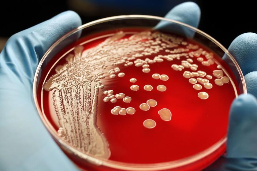 Human hand holding MRSA colonies on blood agar plate. ** OUTS - ELSENT, FPG, CM - OUTS * NM, PH, VA if sourced by CT, LA or MoD **