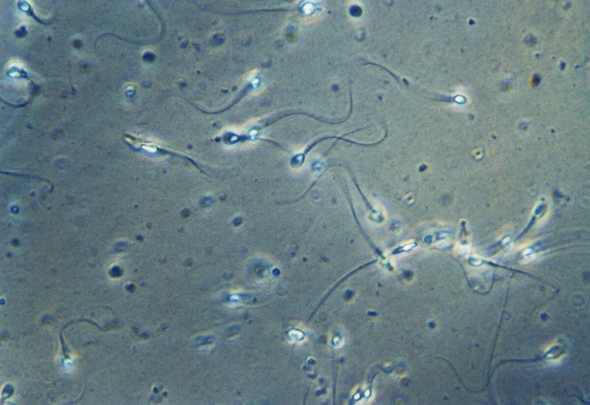 Sperm have a protein that no other cells have. Scientists say its discovery could help them develop a male contraceptive.
