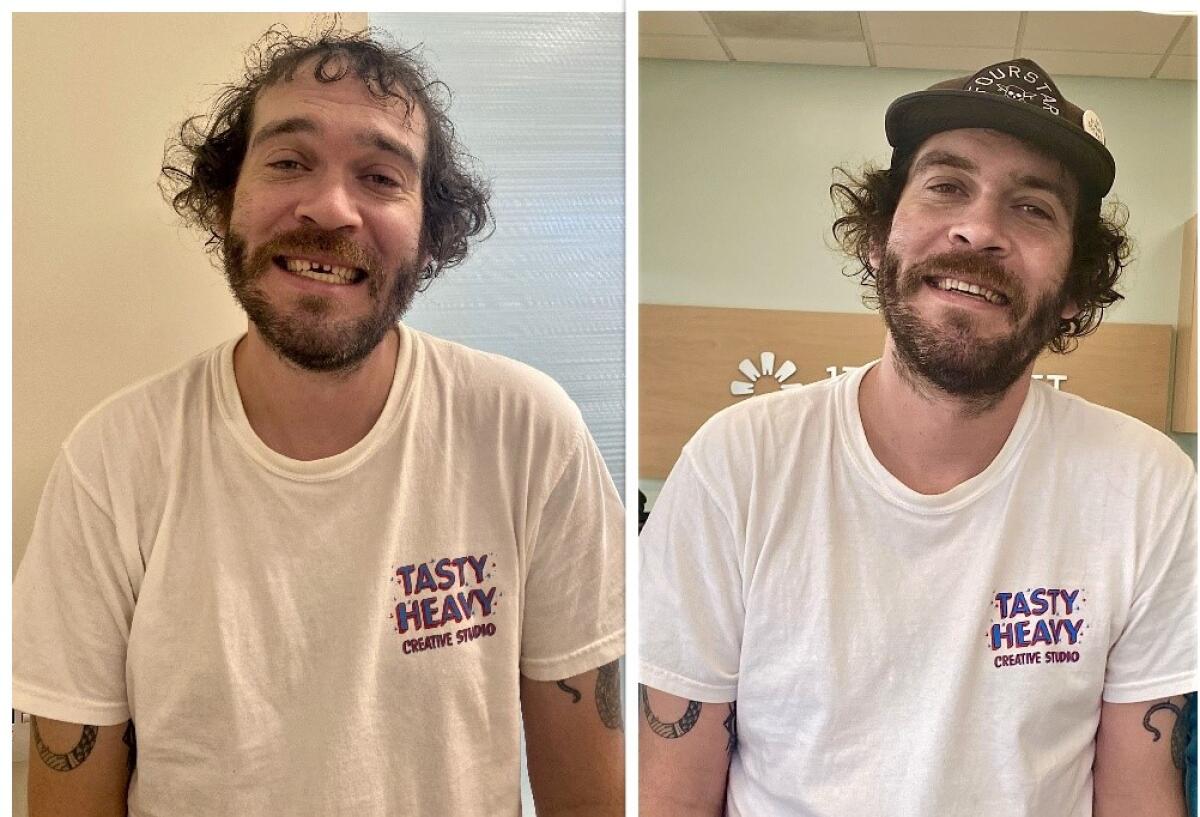 Long Beach resident Chad Taulbee before and after receiving free dental work from 17th Street Modern Dentistry in Costa Mesa.