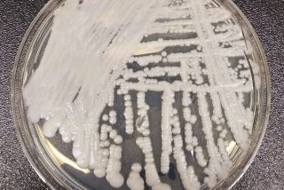 FILE - This undated photo made available by the Centers for Disease Control and Prevention shows a strain of Candida auris cultured in a petri dish at a CDC laboratory. The U.S. toll of drug-resistant “superbug” infections worsened during the first year of the COVID-19 pandemic, health officials said Tuesday, July 12, 2022. After years of decline, the nation in 2020 saw a 15% increase in hospital infections and deaths attributed to some of the most worrisome bacterial infections out there, according to a Centers for Disease Control and Prevention report. (Shawn Lockhart/Centers for Disease Control and Prevention via AP, File)