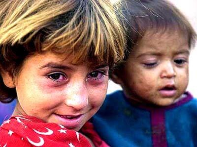 These children, like many at the camp, suffer from eye infections caused by the fetid dust.