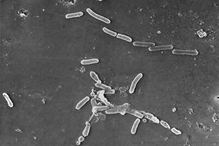 This scanning electron microscope image made available by the Centers for Disease Control and Prevention shows rod-shaped Pseudomonas aeruginosa bacteria. According to a report published Thursday, Jan. 20, 2022, in the medical journal Lancet, antibiotic-resistant germs caused more than 1.2 million deaths globally in one year, according to new research that suggests that so-called “superbugs” have joined the ranks of the world’s leading infectious disease killers. (Janice Haney Carr/CDC via AP)