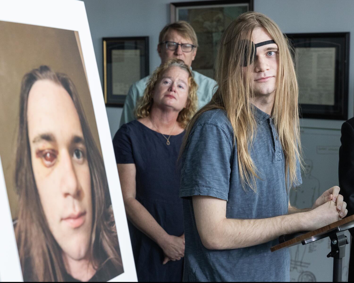 An immigration agent shot out his eye at a 'No Kings' rally. His lawyers plan to file claim against Homeland Security