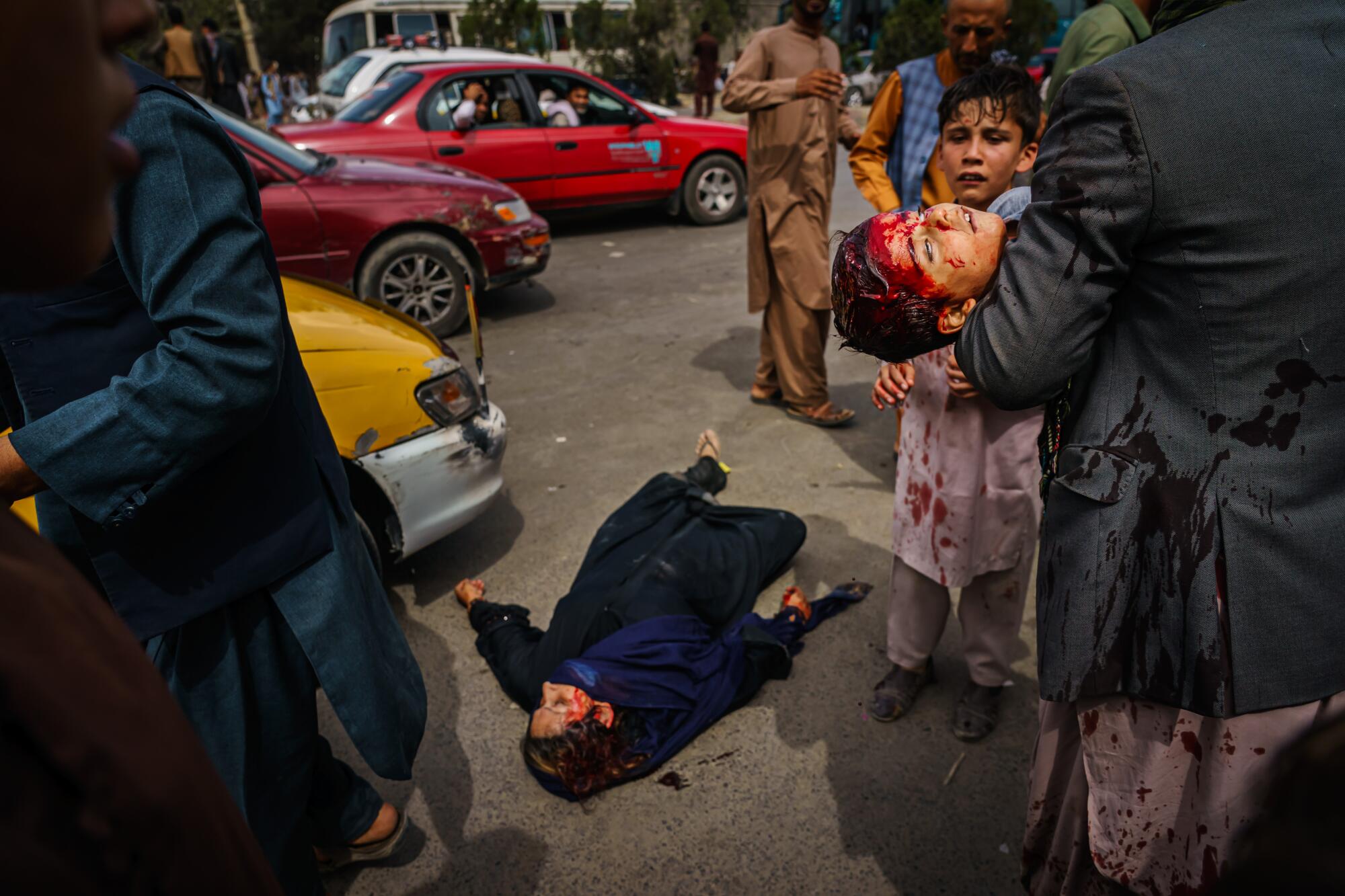 A man carries a bloodied child as a woman lies wounded on the street.