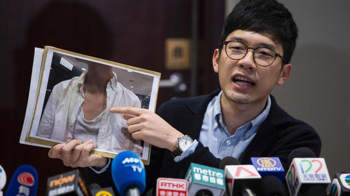 Hong Kong pro-democracy legislator Nathan Law, shown in Hong Kong on Monday, holds a photo of injuries he says he sustained afetr being attacked at Hong Kong International Airport on his return from a recent trip to Taiwan.