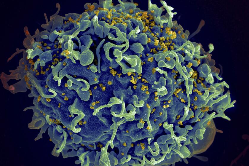 Esta imagen captada con un microscopio de electrones y difundida por los Institutos Nacionales de Salud muestra una célula T humana, en azul, siendo atacada por VIH, en amarillo. (Seth Pincus, Elizabeth Fischer, Austin Athman/National Institute of Allergy and Infectious Diseases/NIH via AP, Archivo)