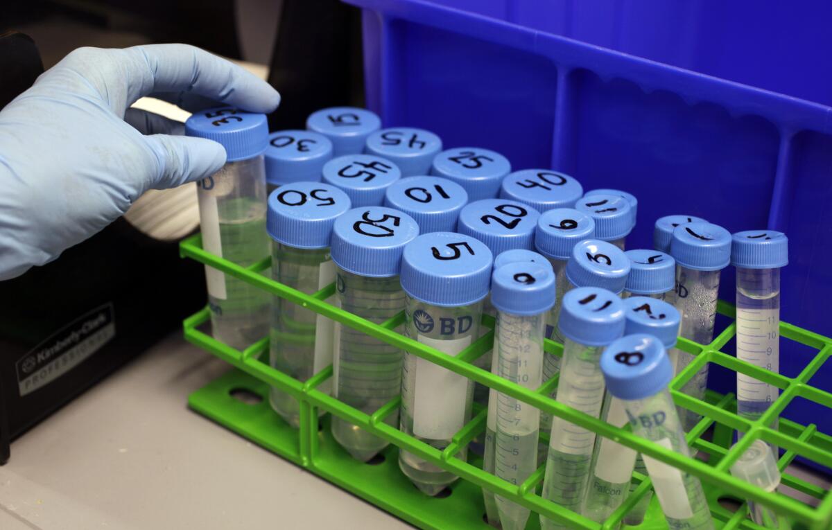 A gloved hand, left, reaches for one of the test tubes in a green holder 