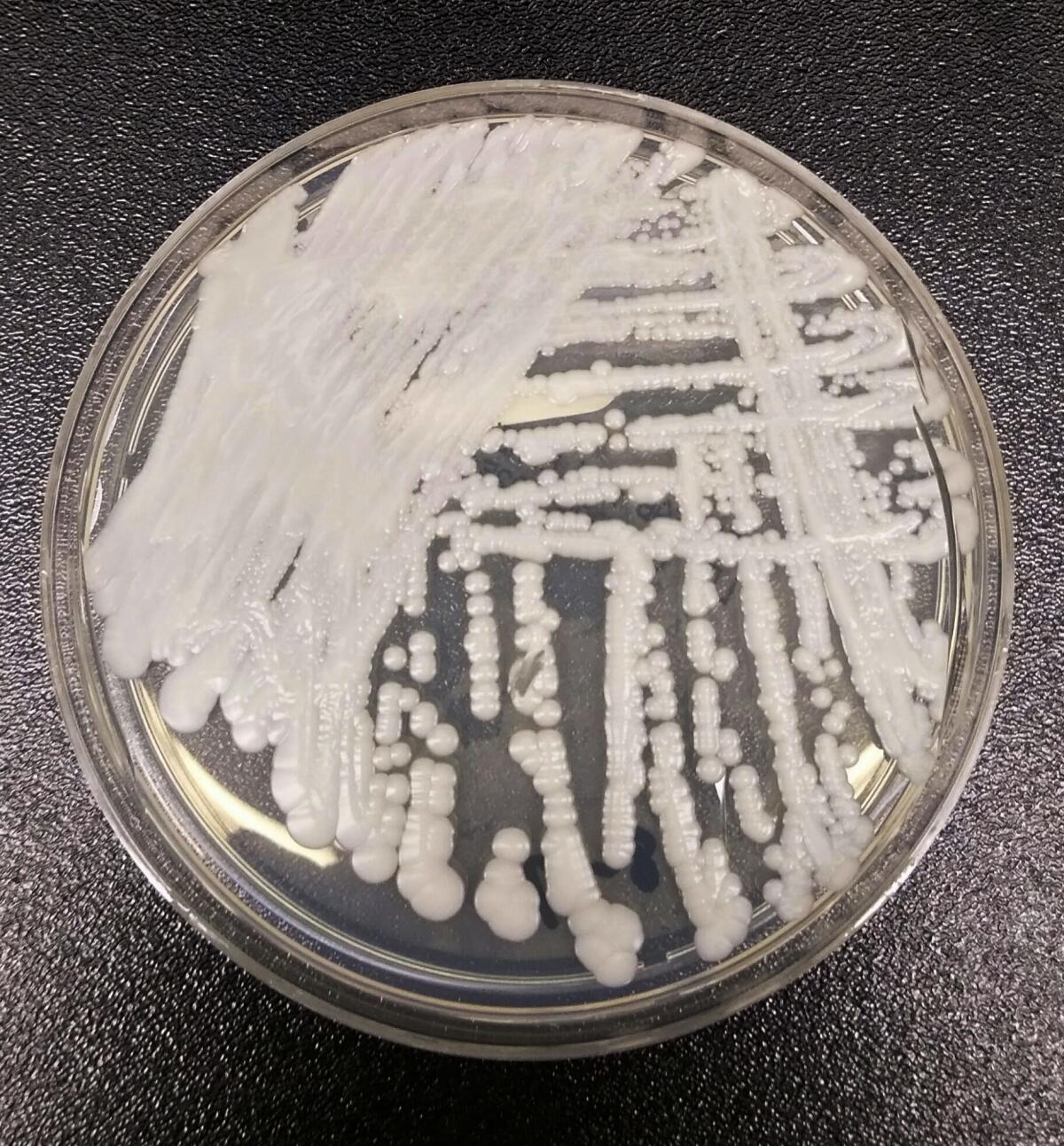 White yeast covers the bottom of a Petri dish