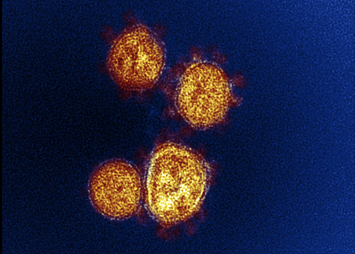 Coronavirus particles emerge from the surface of cells cultured in a lab.