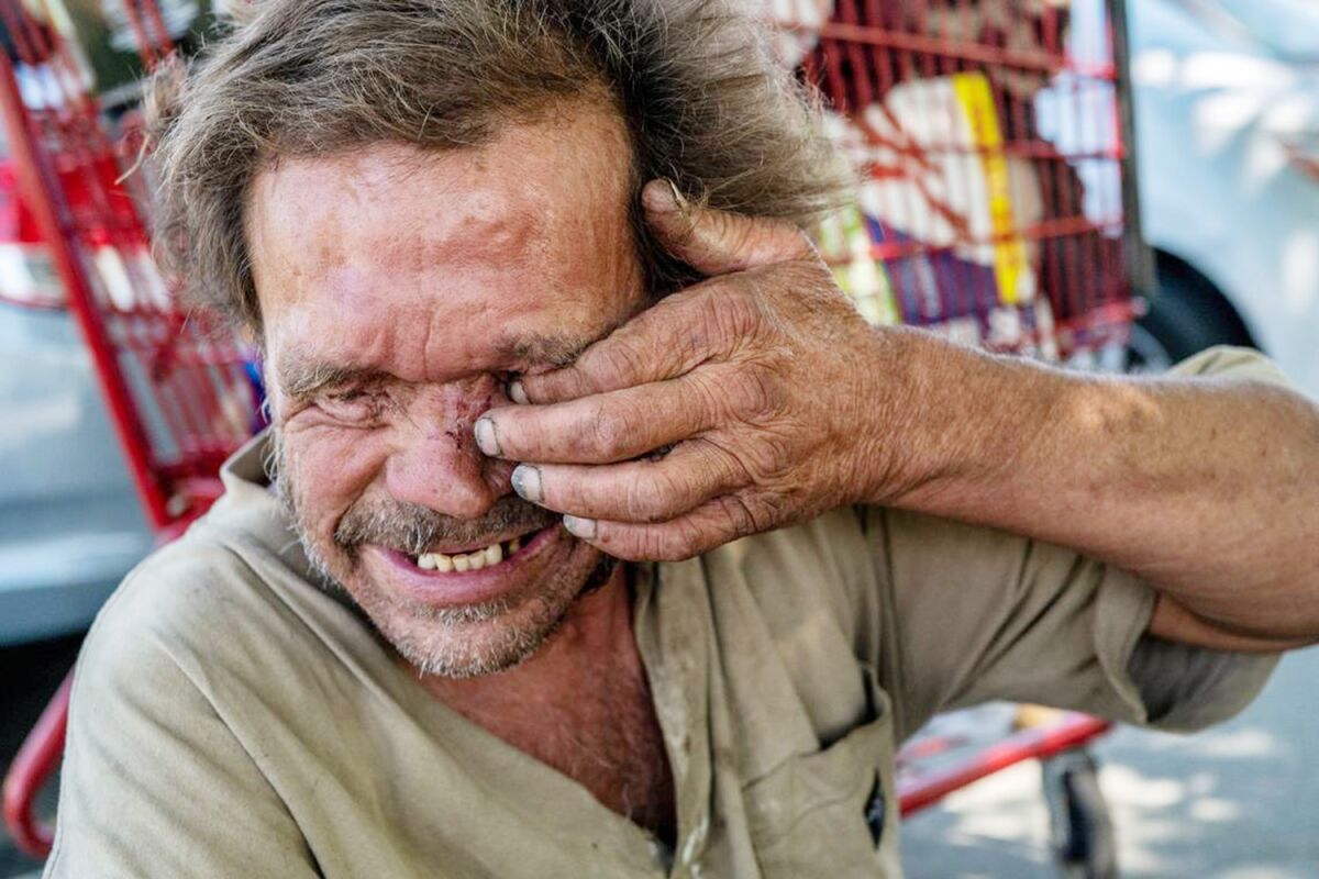 A man rubs his face