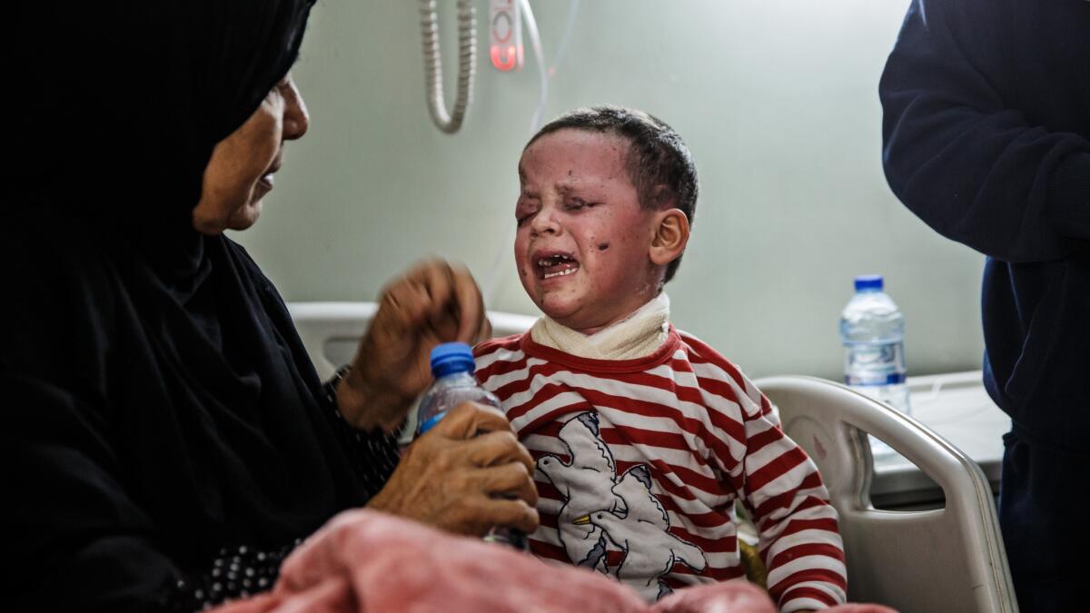 Hawra Hassan, 4, is being treated at a hospital in Irbil. Her mother Meada was killed in the airstrike.