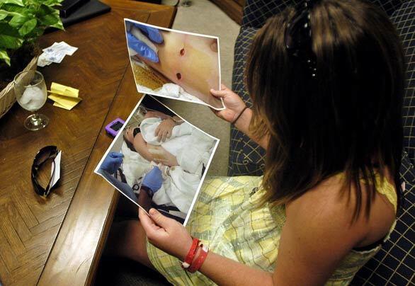 Melissa checks out photographs of her injuries after a news conference at the Orange County Sheriff's Department on Monday.